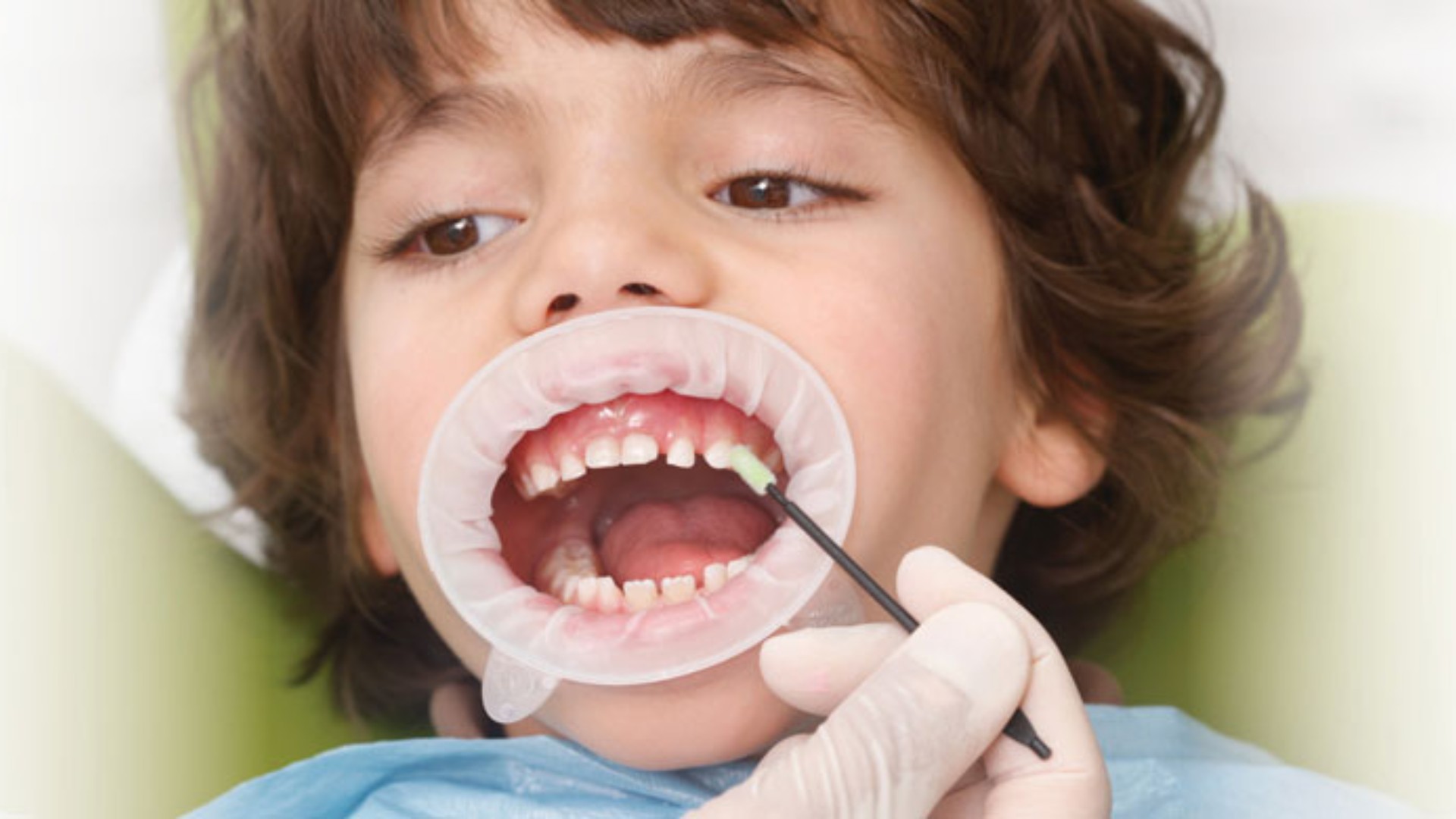 Child Dentistry